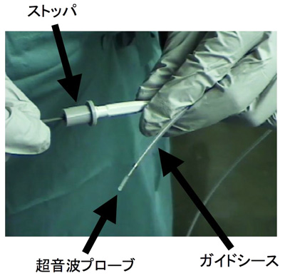 超音波気管支鏡（EBUS）｜東京女子医科大学病院